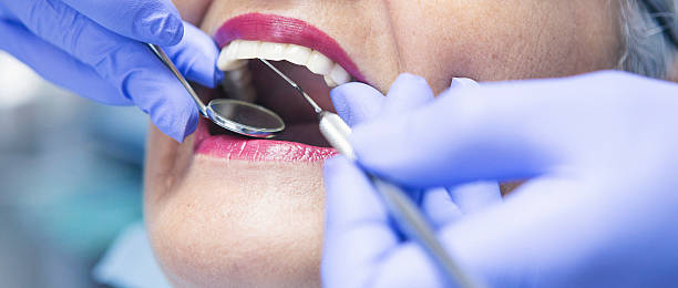 Best Emergency Wisdom Teeth Removal in St Augustine South, FL